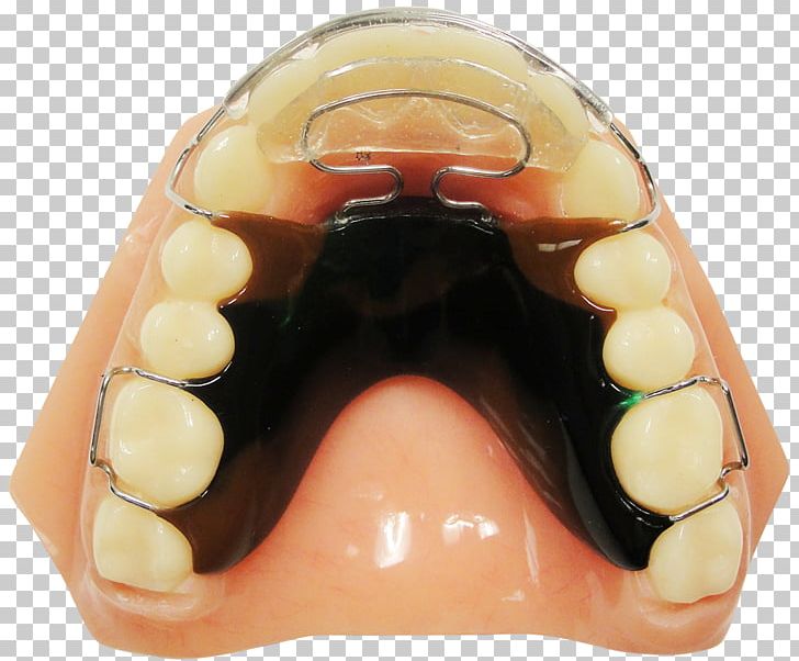ROA PNG, Clipart, Buford, Dentistry, Georgia, Jaw, Maxillary First Molar Free PNG Download