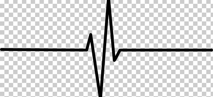 Heart Rate Electrocardiography Pulse PNG, Clipart, Angle, Black And White, Clip Art, Desktop Wallpaper, Drawing Free PNG Download