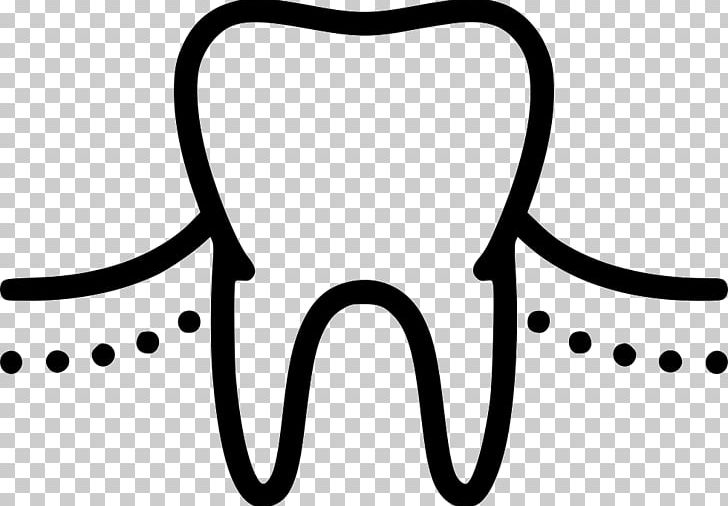 Dentistry Tooth Medicine Mucogingival Junction Physician PNG, Clipart, Black, Black And White, Body Jewelry, Computer Icons, Dentistry Free PNG Download