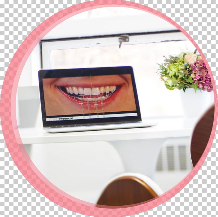 Maria Cardenas PNG, Clipart, Dental Smile, Dentistry, Dentures, Human Tooth, Massachusetts Free PNG Download