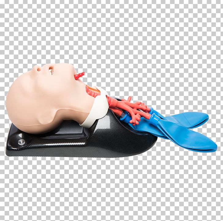 Tracheotomy Cricothyrotomy Airway Management Tracheal Intubation Advanced Trauma Life Support PNG, Clipart, Advanced Trauma Life Support, Bronchus, Cardiopulmonary Resuscitation, Child, Combo Free PNG Download