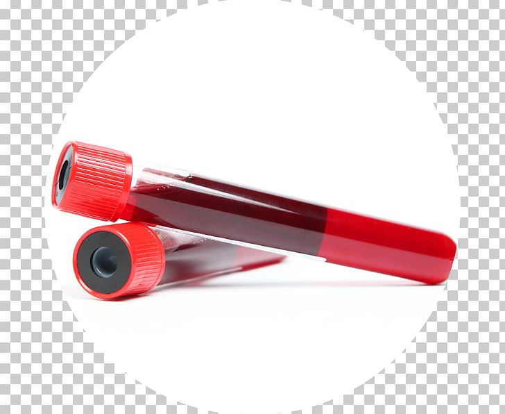 Blood Test Whole Blood Blood Lead Level Disease PNG, Clipart, Blood, Blood Lead Level, Blood Test, Buffy Coat, Diagnostic Test Free PNG Download