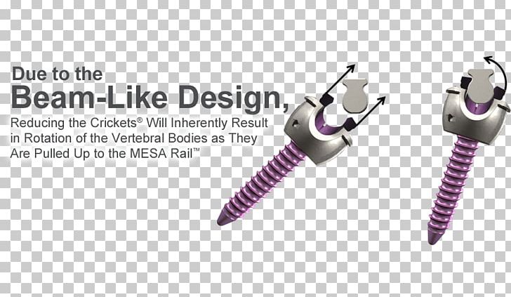 Vertebral Column K2M Group Holdings Keyword Tool Thoracic Vertebrae Spinal Cord PNG, Clipart, Body Jewelry, Com, Deformity, Group, Hardware Free PNG Download