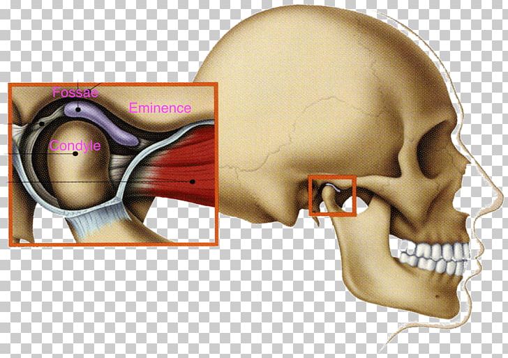 Temporomandibular Joint Dysfunction Mandible Jaw PNG, Clipart, Bone, Cheek, Chewing, Chin, Dentist Free PNG Download