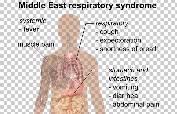 Public Health Middle East Respiratory Syndrome Severe Acute Respiratory Syndrome Pandemic PNG, Clipart, Abdomen, Angle, Arm, Face, Hand Free PNG Download