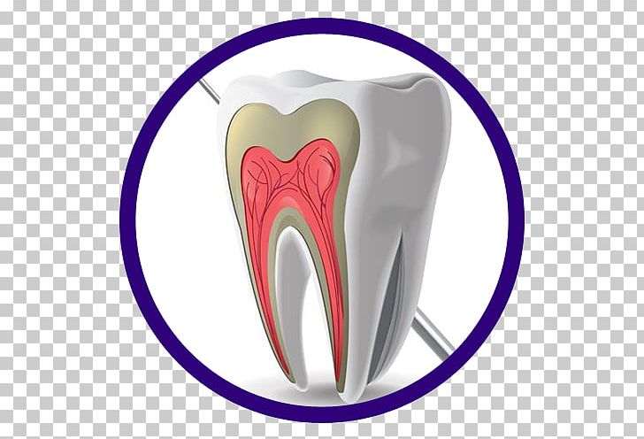 Tooth Decay Dentistry Pulp Dental Software PNG, Clipart, American Dental Association, Dariusz Parkitny Dentist, Dental Implant, Dental Public Health, Dental School Free PNG Download