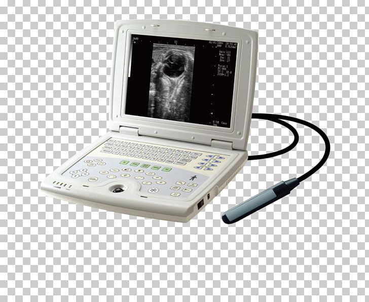 3D Ultrasound Ultrasonography Diagnostic Ultrasound Equine Ultrasound PNG, Clipart, 3d Ultrasound, Doppler Ultrasonography, Electronics, Electronics Accessory, Hardware Free PNG Download