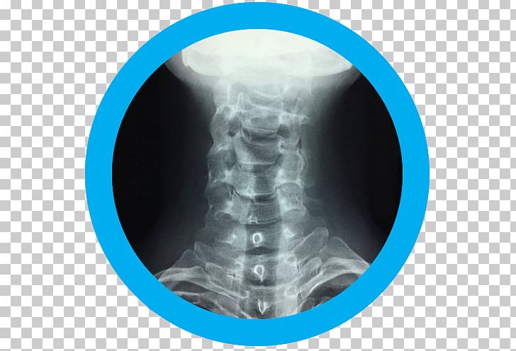 Computed Tomography Radiology Medical Radiography X-ray PNG, Clipart, Computed Tomography, Jaw, Joint, Medical, Medical Imaging Free PNG Download
