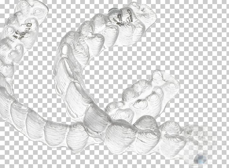 Clear Aligners Orthodontics Dentistry Dental Braces Sunnyvale Dental Aesthetics PNG, Clipart, Black And White, Body Jewelry, Bracelet, Braces, Chain Free PNG Download
