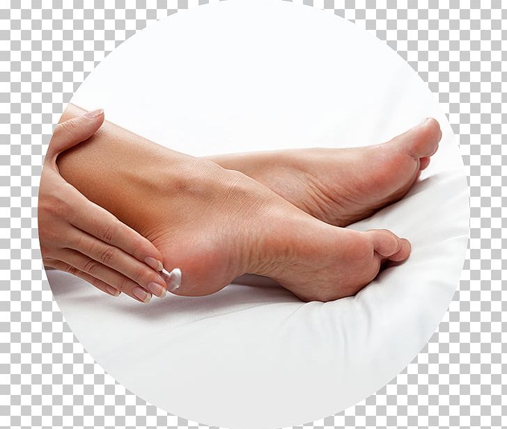 Lotion Diabetic Foot Heel Skin PNG, Clipart,  Free PNG Download