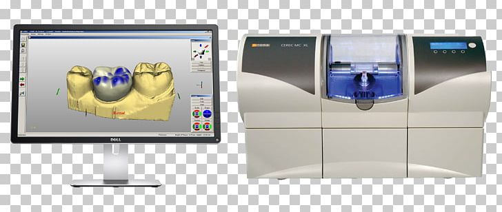 CAD/CAM Dentistry Crown Dental Restoration Inlays And Onlays PNG, Clipart, Bridge, Cadcam Dentistry, Communication, Computer Monitor Accessory, Crown Free PNG Download