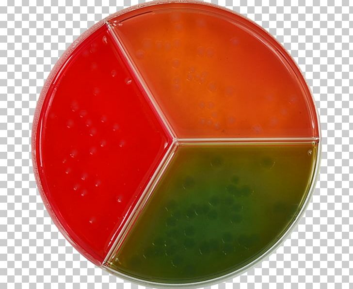 Bowl Dish Network PNG, Clipart, Agar, Bowl, Dish, Dish Network, Media Free PNG Download