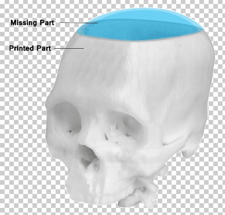 3D Printing Printer Three-dimensional Space Autodesk Inventor PNG, Clipart, 3d Printing, Autodesk Inventor, Bone, Computer Software, Desktop Computers Free PNG Download