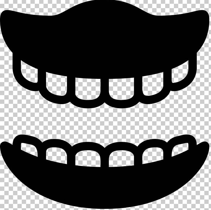 Dentures Computer Icons Dentistry Dental Implant PNG, Clipart, 3d Dental Treatment For Toothache, Artwork, Black, Black And White, Computer Icons Free PNG Download