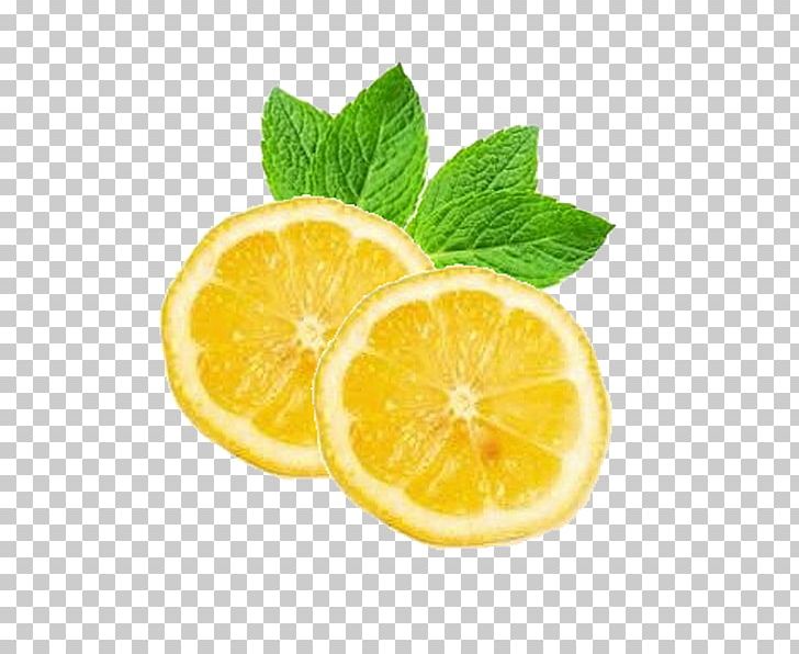 Lemon Keglevich Juice Food Vitamin C PNG, Clipart, Food, Juice, Keglevich, Lemon, Vitamin C Free PNG Download