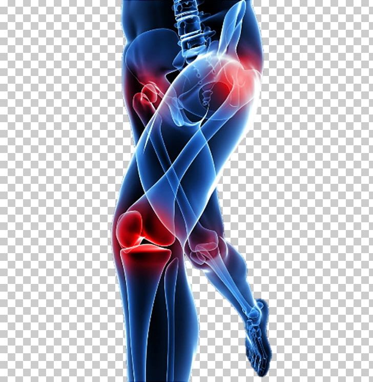 Low Back Pain Knee Pain Pain Management Neck Pain PNG, Clipart, Ache, Arthritis, Back Pain, Computer Wallpaper, Do It Free PNG Download