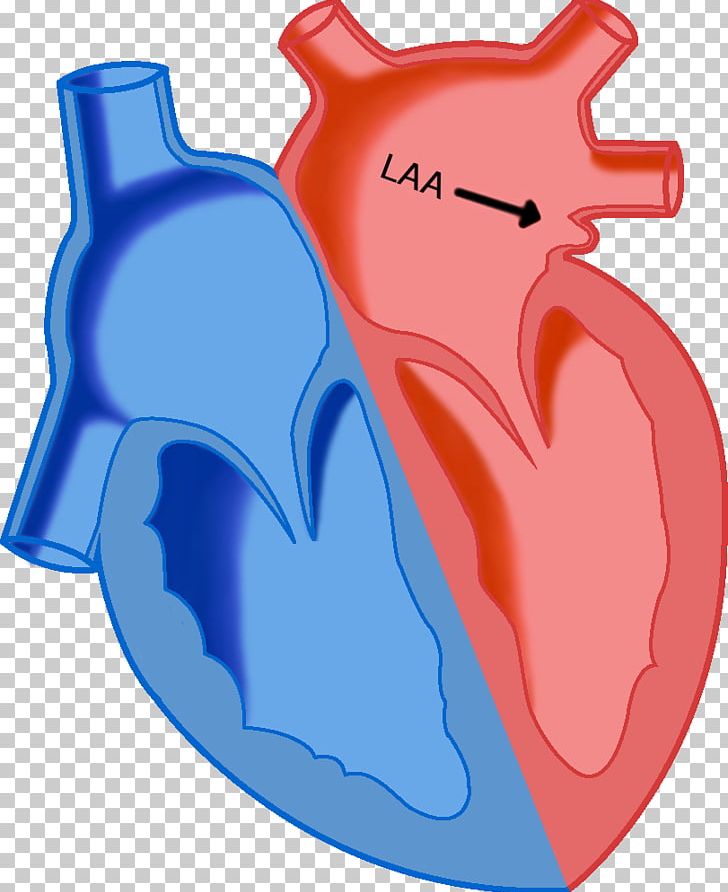 Heart Los Angeles Angels Atrial Septal Defect Atrium Left Atrial Appendage PNG, Clipart, Atrial Septal Defect, Atrium, Birth Defect, Blood, Cardiac Surgery Free PNG Download