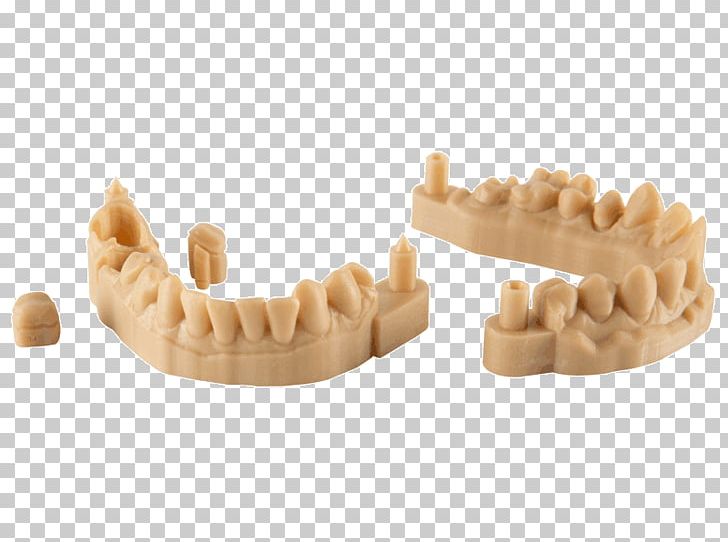 3D Printing Resin 3D Printers Manufacturing PNG, Clipart, 3d Computer Graphics, 3d Printers, 3d Printing, 3d Tooth, Dentistry Free PNG Download