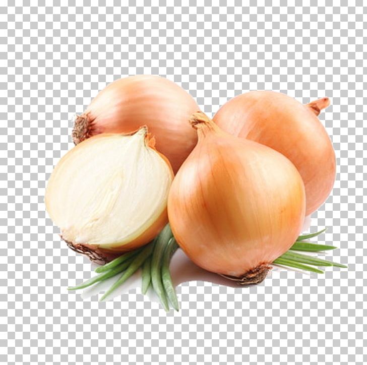 Potato Onion Vegetable Food Yellow Onion PNG, Clipart, Apple Cider Vinegar, Cooking, Eating, Garlic, Green Onion Free PNG Download
