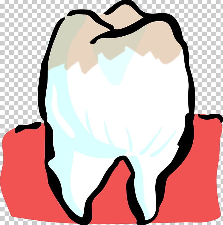 Human Tooth Dentist PNG, Clipart, 4 P, Artwork, Cavity, Deciduous Teeth, Dental Anatomy Free PNG Download