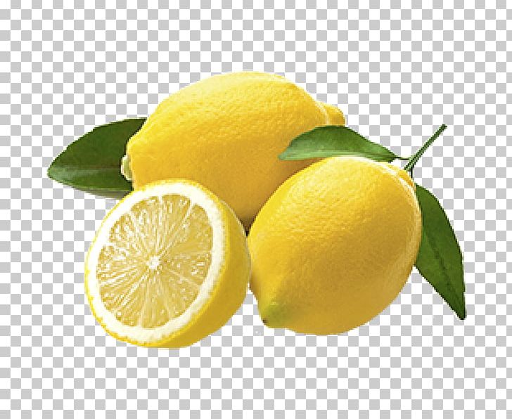 Lemon Juice Citron Fizzy Drinks PNG, Clipart, Apple Cider Vinegar, Baking, Citric Acid, Citron, Citrus Free PNG Download