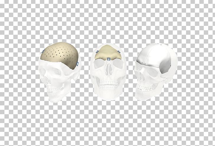 Skull Stryker Corporation Implant Jaw Bone PNG, Clipart, Bone, Dentistry, Dura Mater, Fantasy, Health Free PNG Download