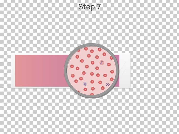 White Blood Cell Blood Film PNG, Clipart, Blood, Blood Cell, Blood Film, Blood Smear, Brand Free PNG Download