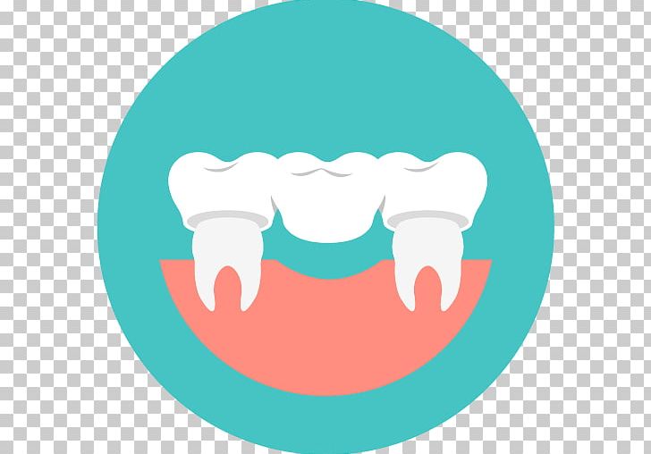 Stomatološka Ordinacija Grin Dental Care Dentistry Dental Surgery Tooth PNG, Clipart, Aqua, Bridge, Clinic, Dental Extraction, Dental Implant Free PNG Download