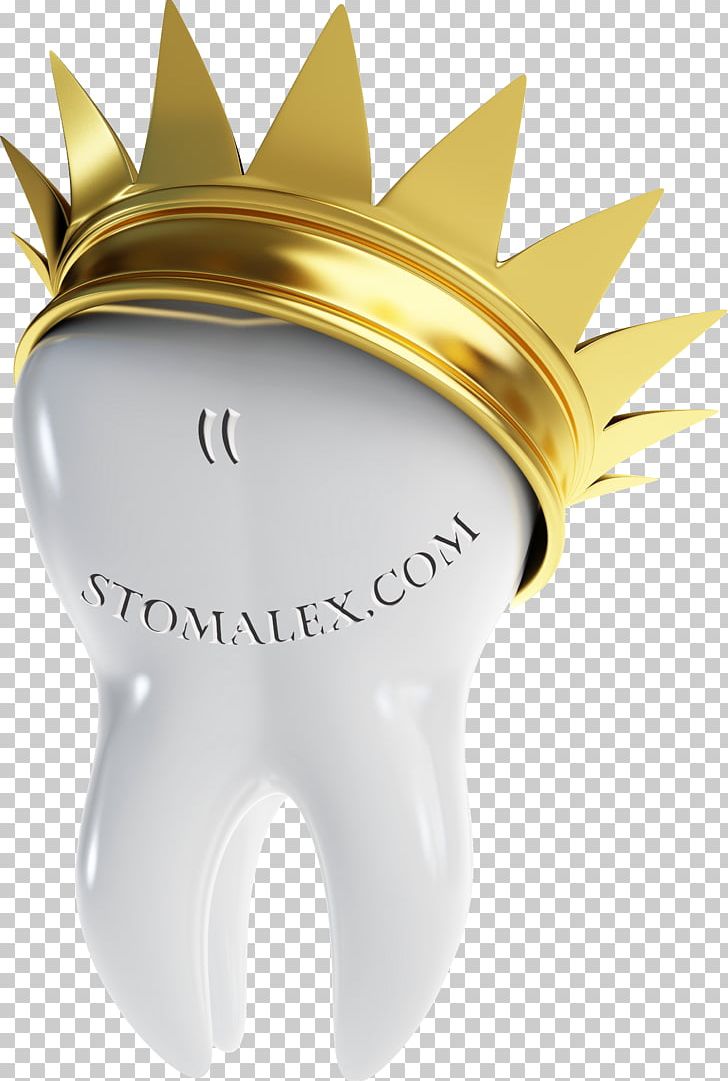 Crown Dental Restoration Dentistry Dental Implant Dentures PNG, Clipart, Bridge, Crown, Dental Implant, Dental Restoration, Dentist Free PNG Download