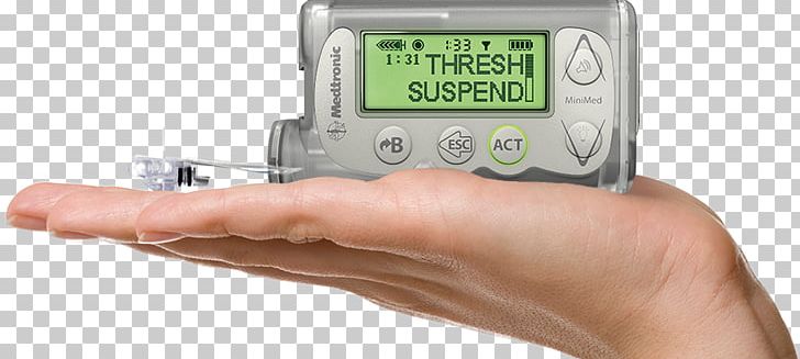 Insulin Pump Minimed Paradigm Medtronic Diabetes Mellitus PNG, Clipart, Artificial Pancreas, Basal, Blood Glucose Meters, Blood Glucose Monitoring, Continuous Glucose Monitor Free PNG Download