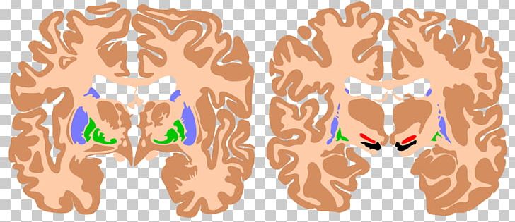 Brain Basal Ganglia Agy Substantia Nigra Ganglion PNG, Clipart, Agy, Anatomy, Basal Ganglia, Brain, Caudate Nucleus Free PNG Download