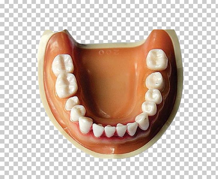 Tooth Dentures Mouth Prototype Crown PNG, Clipart, Decoration, Denture, Dentures, Free Logo Design Template, Habit Free PNG Download