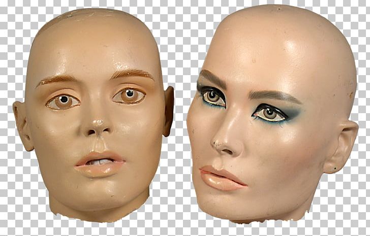 Hair Loss Head Kaalheid Model PNG, Clipart, Canities, Capelli, Cheek, Chin, Clothing Free PNG Download