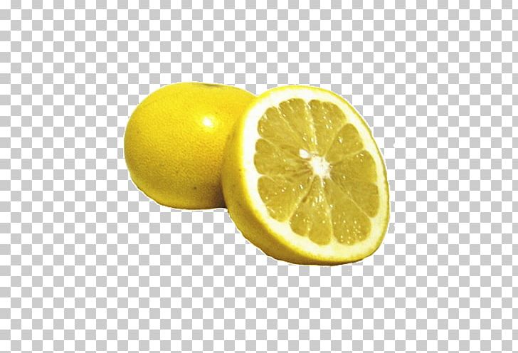 Lemon-lime Drink Juice Citron Grapefruit PNG, Clipart, Citric Acid, Citron, Citrus, Citrus Junos, Food Free PNG Download