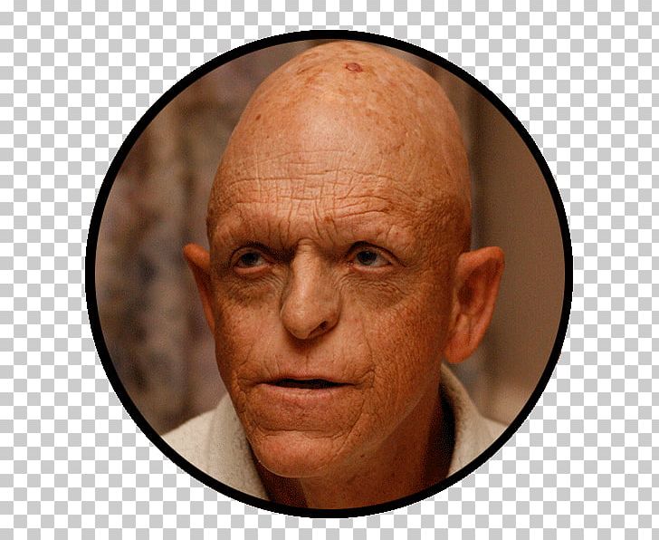 Michael Berryman The Hills Have Eyes Horror Los Angeles PNG, Clipart, Billy Hughes, Casting, Cheek, Chin, Com Free PNG Download