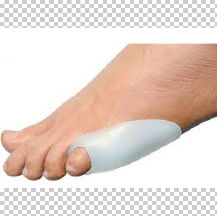 Tailor's Bunion Toe Medicine Podiatry PNG, Clipart,  Free PNG Download