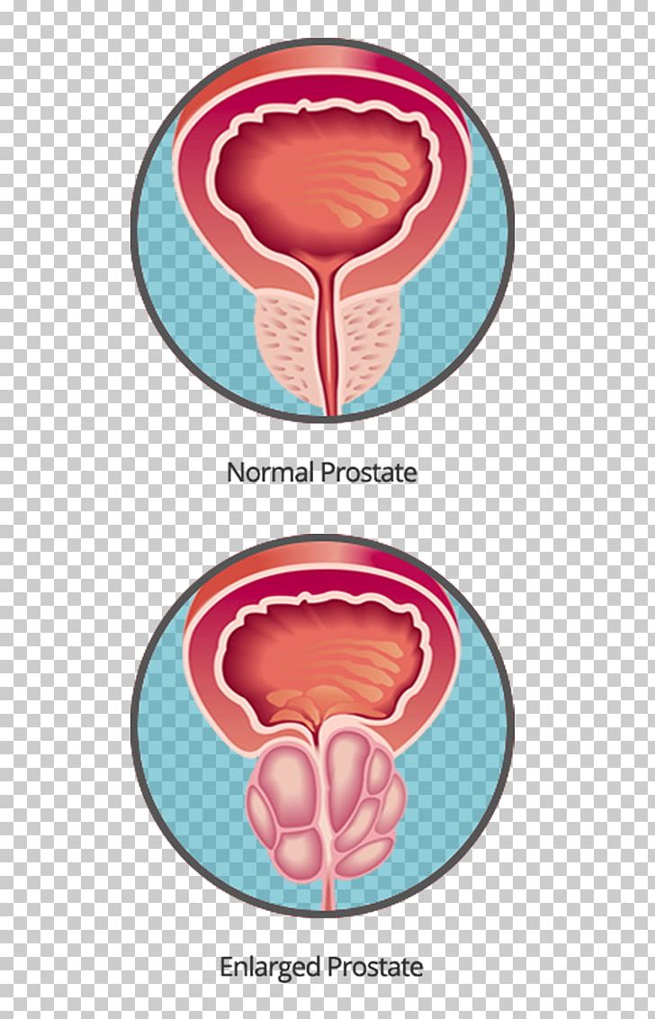 Organism PNG, Clipart, Art, Human Body, Organ, Organism, Prostate Free PNG Download