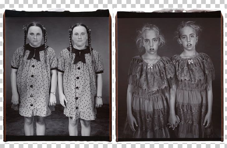 Identical Twins PNG, Clipart, Artist, Black And White, Costume Design, Diane Arbus, Eye Free PNG Download