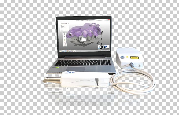 Nika Treyd Scanner CAD/CAM Dentistry Digital Data PNG, Clipart, 3d Dental Treatment For Toothache, Cadcam Dentistry, Computeraided Design, Computeraided Manufacturing, Computer Hardware Free PNG Download