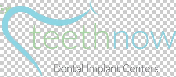 Dental Implant All-on-4 American Board Of Periodontology Dentistry PNG, Clipart, Allon4, Aqua, Area, Blue, Brand Free PNG Download