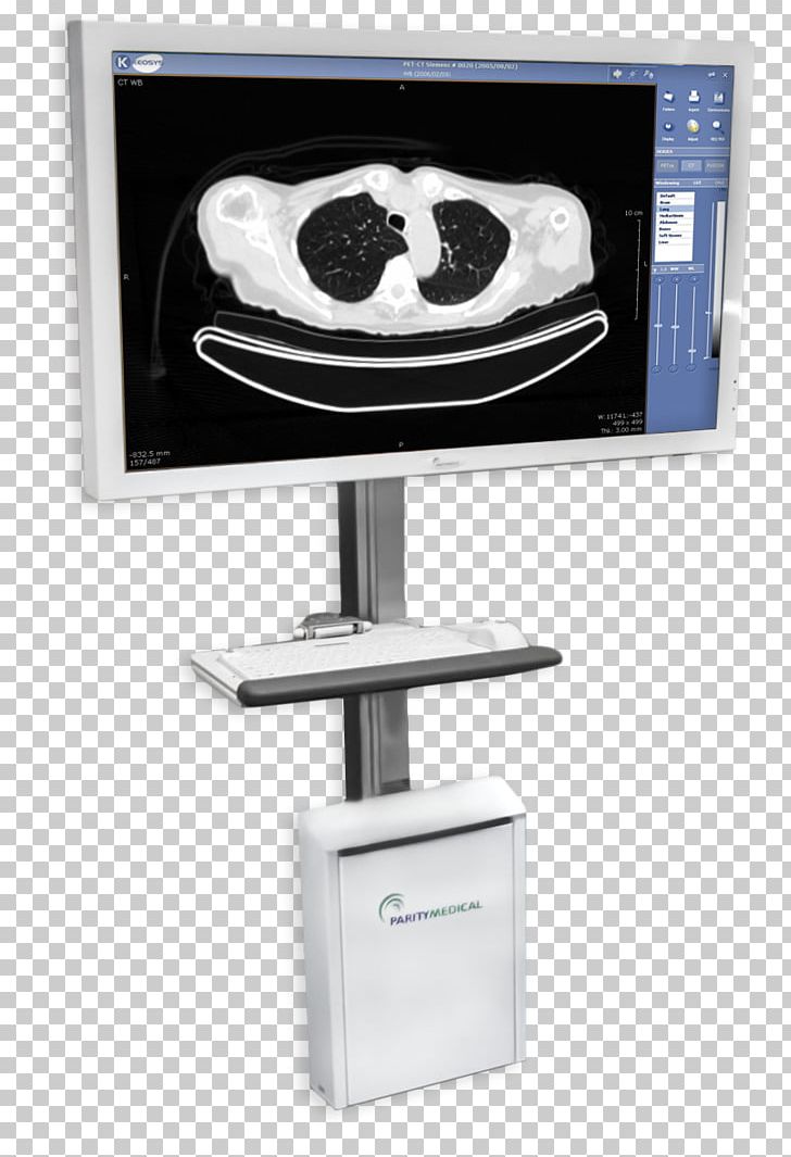 Medicine Archiving And Communication System Radiology Display Device McKesson Corporation PNG, Clipart, Computer, Computer Monitor Accessory, Computer Monitors, Computer Software, Display Device Free PNG Download