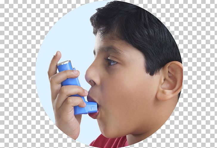 Metered-dose Inhaler Asthma Pharmaceutical Drug Allergy PNG, Clipart, Albuterol, Allergic Asthma, Allergy, Asthma, Beclometasone Dipropionate Free PNG Download
