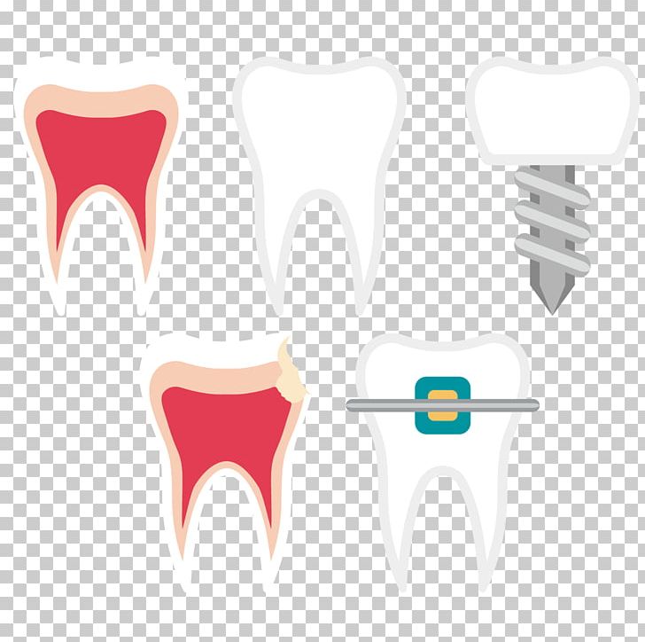 Tooth Dentistry Euclidean PNG, Clipart, Baby Teeth, Clean, Dental Care, Dental Clinic, Dental Instruments Free PNG Download