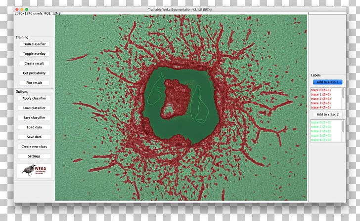 J Segmentation Analysis PNG, Clipart, Angiogenesis, Aorta, Assay, Brand, Graphic Design Free PNG Download