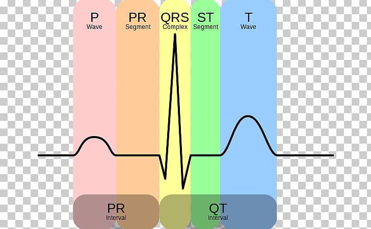 Electrocardiogram Sinusrytme QT Interval QRS Complex Heart PNG, Clipart,  Free PNG Download